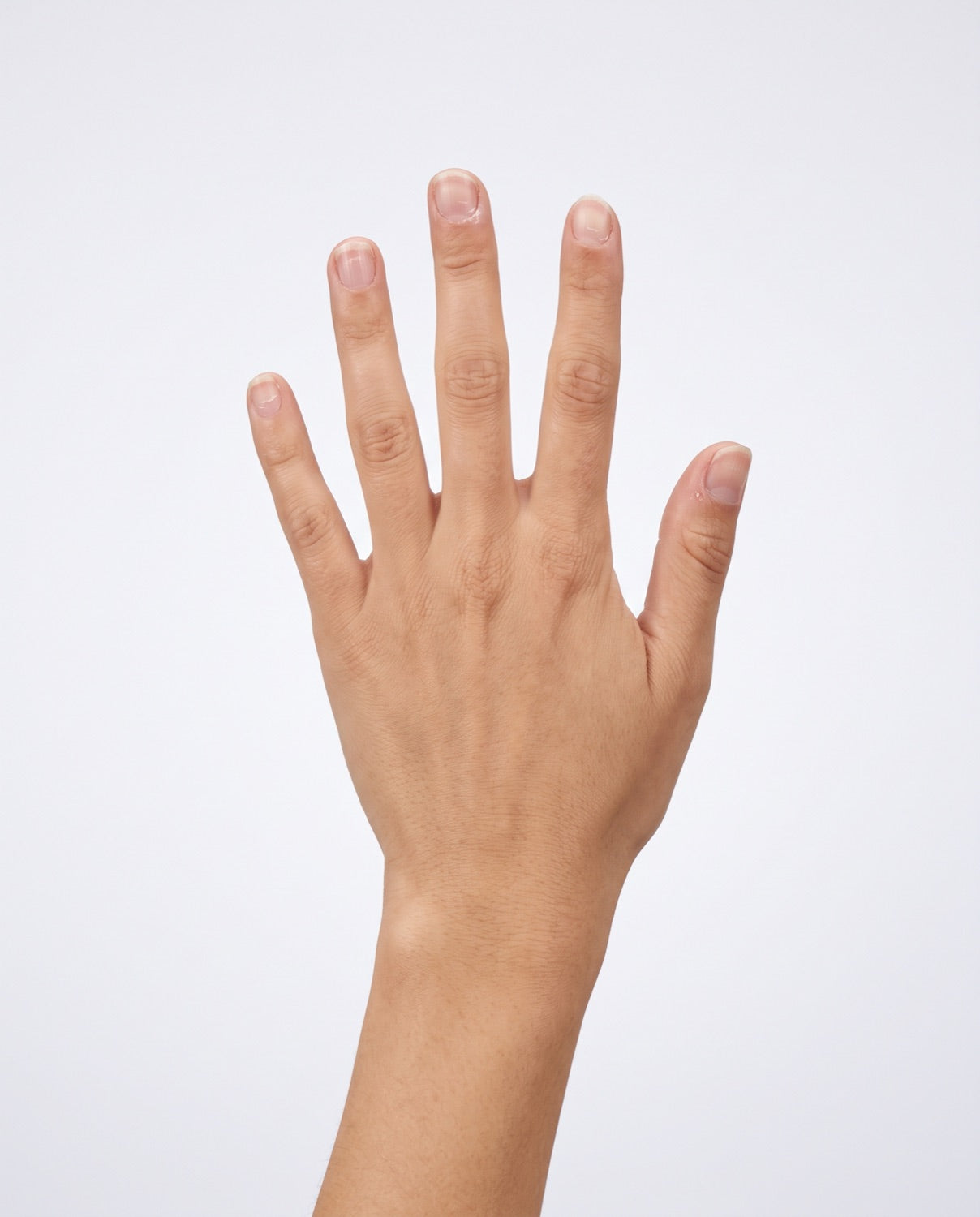 Bare nails showing peeling and ridges after glue removal