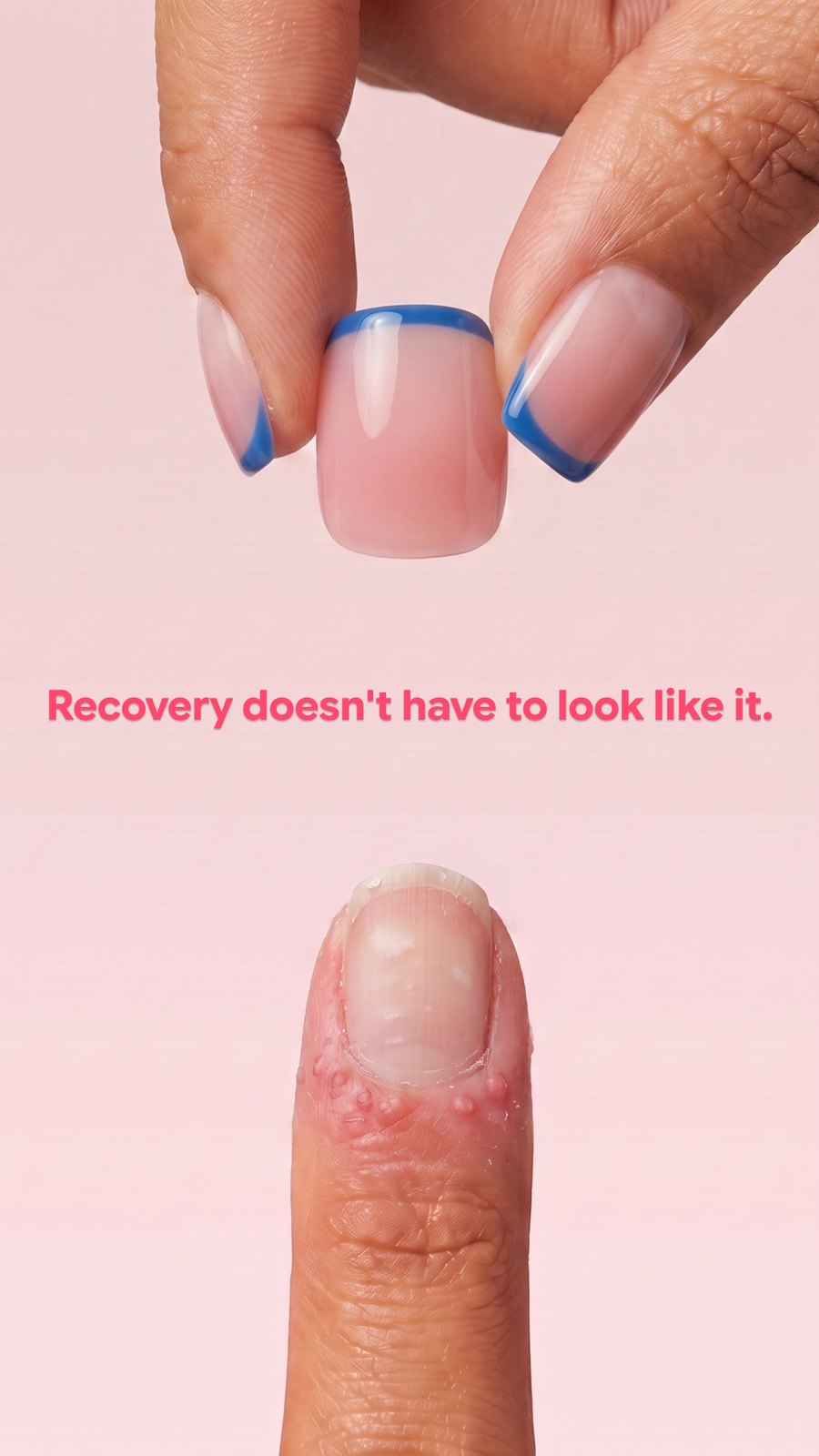 Blue french press-ons held above a bare recovering nail, captioned: recovery doesn't have to look like it.
